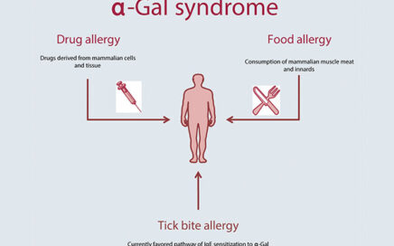 Alfa-galsyndroom: nieuwe mogelijke complicatie bij tekenbeet